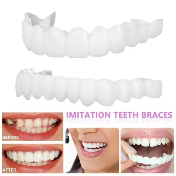 1 Pair Snap-On Veneers Protect Your Teeth Dentures For Temporary Dental Restorations Veneers For Upper And Lower Jaws - Image 6