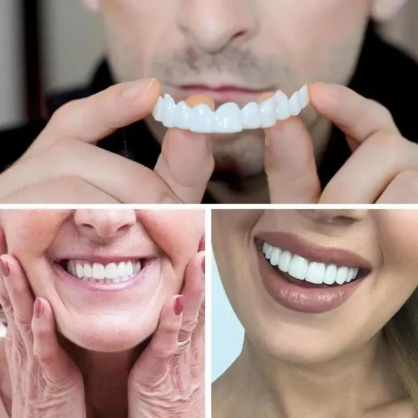 1 Pair Snap-On Veneers Protect Your Teeth Dentures For Temporary Dental Restorations Veneers For Upper And Lower Jaws - Image 4