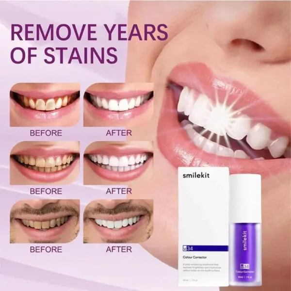 30ml V34 SmileKit Purple Toothpaste Removes Tartar Clean Oral Hygiene Fresh Breath Whitening Teeth Care Products - Image 2